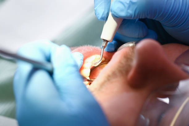 Best Emergency Dental Services for Seniors in Lookout Mountain, TN