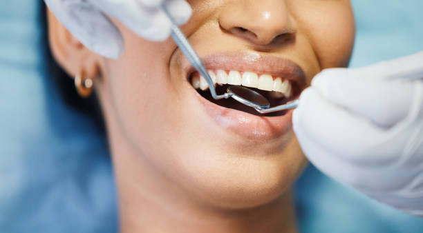 Best Emergency Dentist for Lost Fillings or Crowns in Lookout Mountain, TN